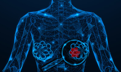 Detection of breast cancer. A tumor under a magnifying glass. Polygonal design of interconnected elements. Blue background.