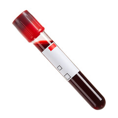 Blood sample in test tube isolated on transparent background for medical analysis, research, and diagnostics