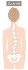 背骨の歪み　女性