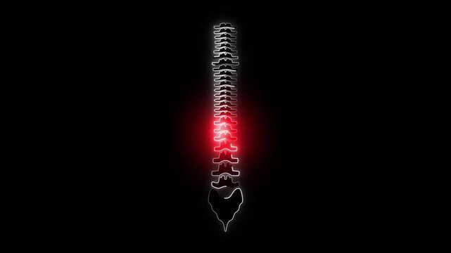 Neon animation of low back pain with glowing lumbar spine and sciatic nerve highlighting spinal discomfort. bright lumbar spine, sciatic nerve pain concept for treatment, healthcare and physiotherapy