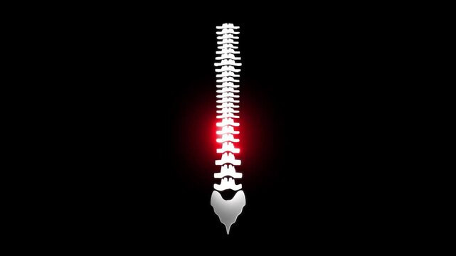 Neon animation of low back pain with glowing lumbar spine and sciatic nerve highlighting spinal discomfort. bright lumbar spine, sciatic nerve pain concept for treatment, healthcare and physiotherapy