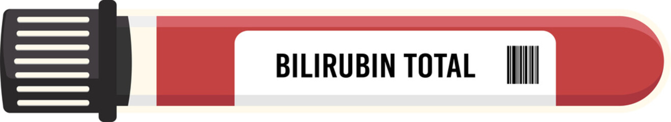 bilirubin total