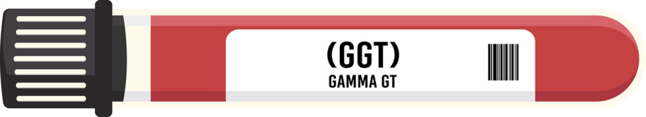 GGT