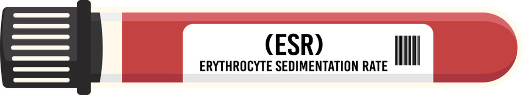 ESR
