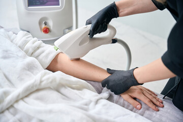 Close up of cosmetologist receiving laser epilation treatment for male hand