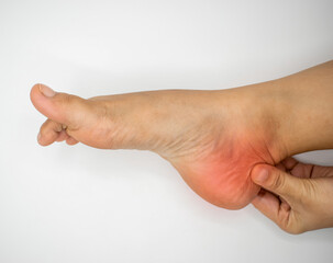 Experiencing Heel Pain, A Common Foot Discomfort Issue