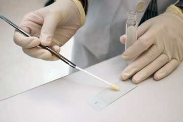 A lab technician prepares a microscope slide by spreading a sample using a cotton swab, wearing gloves to ensure sterile conditions during microbiological and medical analysis.