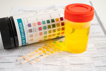 Urinalysis, urine cup with reagent strip pH paper test and comparison chart in laboratory.