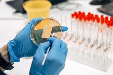 Bacterial colonies ferment lactose agar in the microbiology laboratory during an experiment. Concept studying and diagnosing intestinal infections using specialized culture media.