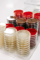 Petri dishes with cultures in the laboratory. A concept that analyzes the growth of microorganisms...