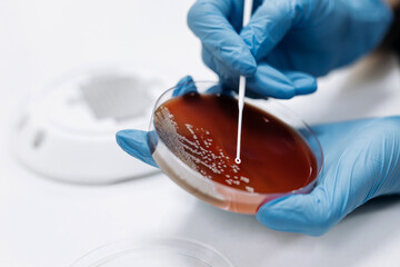Bacterial colonies ferment lactose agar in the microbiology laboratory during an experiment....