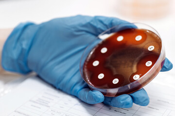 The microbiologist diognoses the result of the examination in the laboratory. The concept of...
