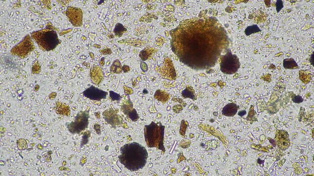microorganisms and soil biology, with nematodes and fungi under the microscope. in a soil and compost sample