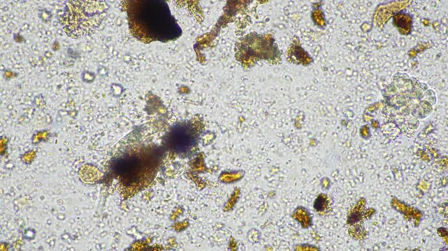 microorganisms and soil biology, with nematodes and fungi under the microscope. in a soil and compost sample
