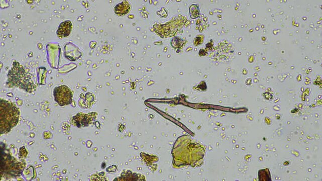 microorganisms and soil biology, with nematodes and fungi under the microscope. in a soil and compost sample