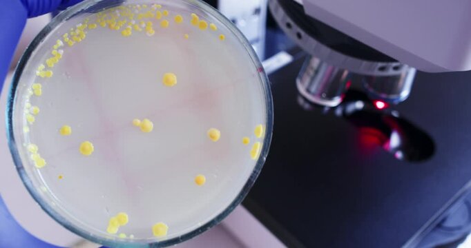 Petri dish with yellow colonies of bacteria, powerful laboratory microscope in the background. Study of bacteria in the laboratory.