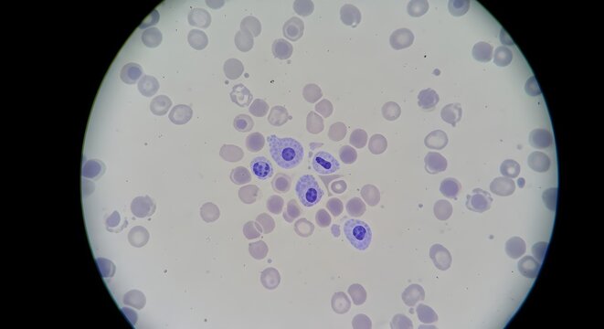 Microscopic View of Human Blood Cells White Blood Cells (Leukocytes) and Red Blood Cells (Erythrocytes) Seen in a Blood Smear.