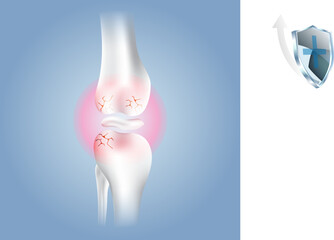 bone health, medical graphic, x-ray knee, joint disease, health comparison