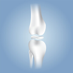 bone brokenbone health, medical graphic, x-ray knee, joint disease, health comparison