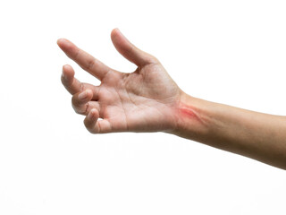 Wrist pain, woman injury hand from weight-lifting exercise, problem bone gout osteoporosis, illness muscle.