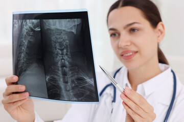 Doctor examining MRI scan in hospital, selective focus