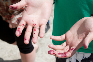 Dirty hands. Hands stained with berries