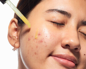 South East Asian Indonesian Women Caring for Natural Pimple Face Condition With Serum Routine in Bright Indoor Setting