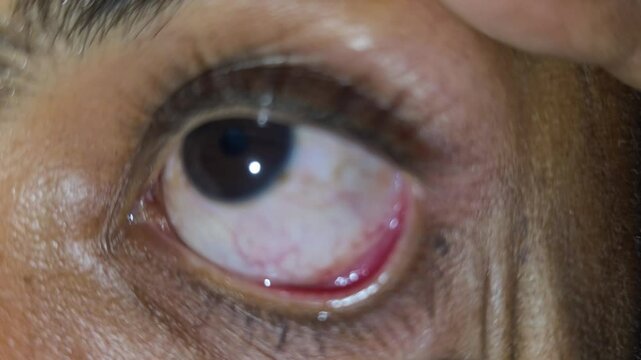 close up of human eyeball Moving Around