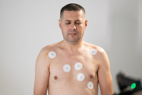 A middle-aged man is undergoing a medical stress test on a treadmill, connected to ECG electrodes for heart monitoring in a clinical environment