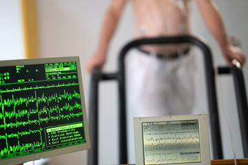 A middle-aged man is undergoing a medical stress test on a treadmill, connected to ECG electrodes for heart monitoring in a clinical environment