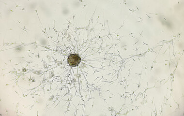 Glioblastoma cell culture.