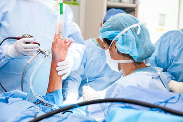 Group of orthopedic surgeons performing a wrist arthroscopy on a male patient. Female doctor performing a surgery. Orthopedic surgeon. Surgery and insurance concept.