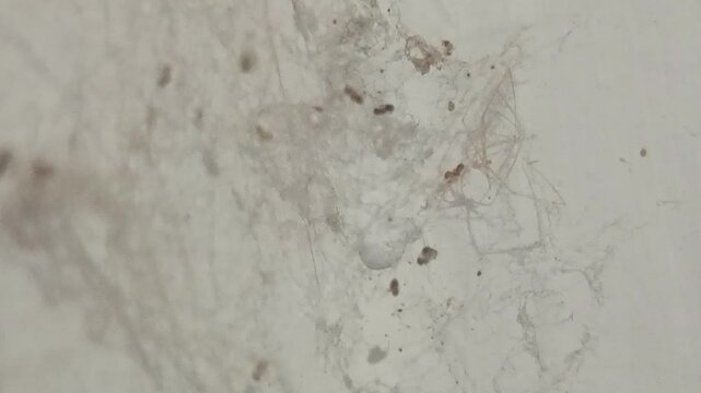 Delicate yet deadly, the spider’s web captures both prey and attention with its intricate structure. 