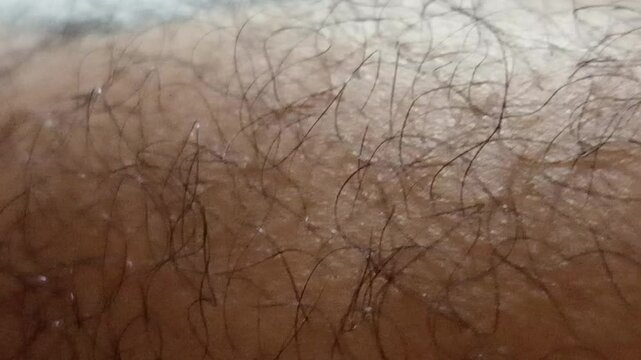 focus on the anatomy, function, and texture of our extremities, highlighting their importance in motion, balance, and human interaction. Ideal for content in anatomy visuals