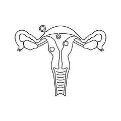 uterine fibroids