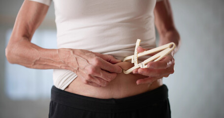Female Bariatric Surgeon Carefully Measuring Patient's Belly Fat