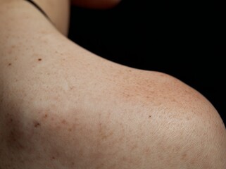 Naklejka premium Asian women over thirty often experience facial blemishes and freckles due to ultraviolet or blue light exposure, prompting the use of sunscreen creams, gels, and skincare products