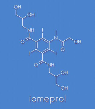 Iomeprol radiocontrast drug molecule. Skeletal formula.