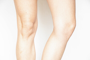 Female legs on white background, health, medical examinations theme