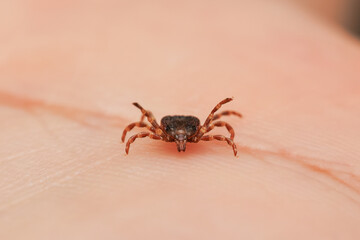 Tick bitting on human skin
