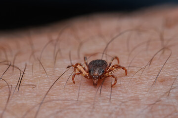 Tick bitting on human skin
