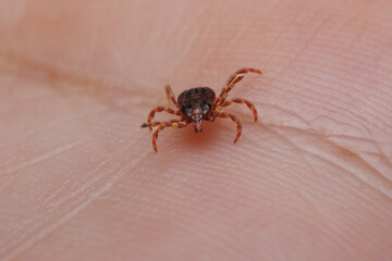 Tick bitting on human skin
