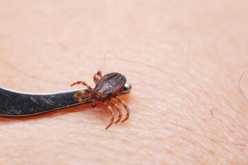 Tick bitting on human skin
