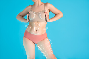 Full body liposuction, legs, hips, abdomen and breast augmentation, fat and cellulite removal concept, overweight female body with painted surgical lines and arrows