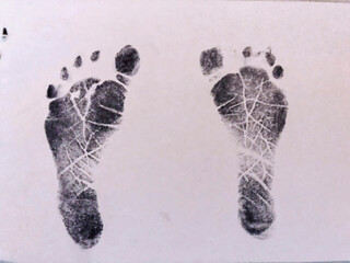 Image of the newborn medicine heel prick test. Brasilia, Brazil, 2020