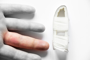Broken finger with medical splint, male hand injury, swelling and redness