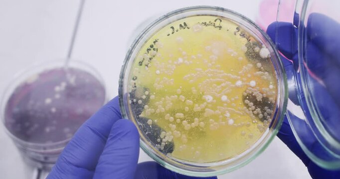 White bacterial colonies on yellow agar medium in petri dish under study in laboratory, scientist opening dish, close-up.