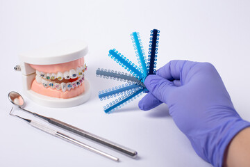 Orthodontic color samples held by gloved hand with dental model in background.