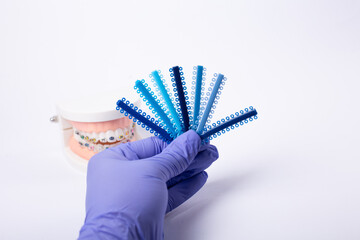 Orthodontic color samples held by gloved hand with dental model in background.
