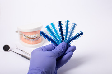 Orthodontic color samples held by gloved hand with dental model in background.